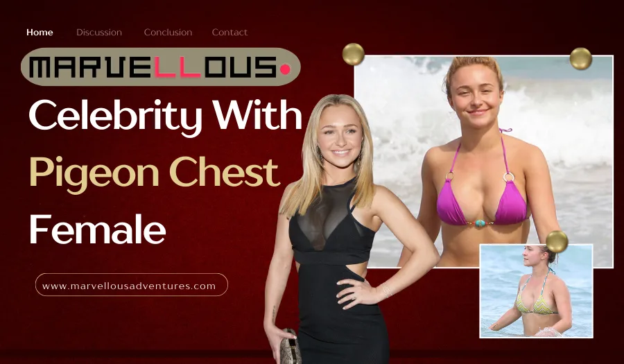 Celebrities With Pigeon Chest Female: Breaking Beauty Standards